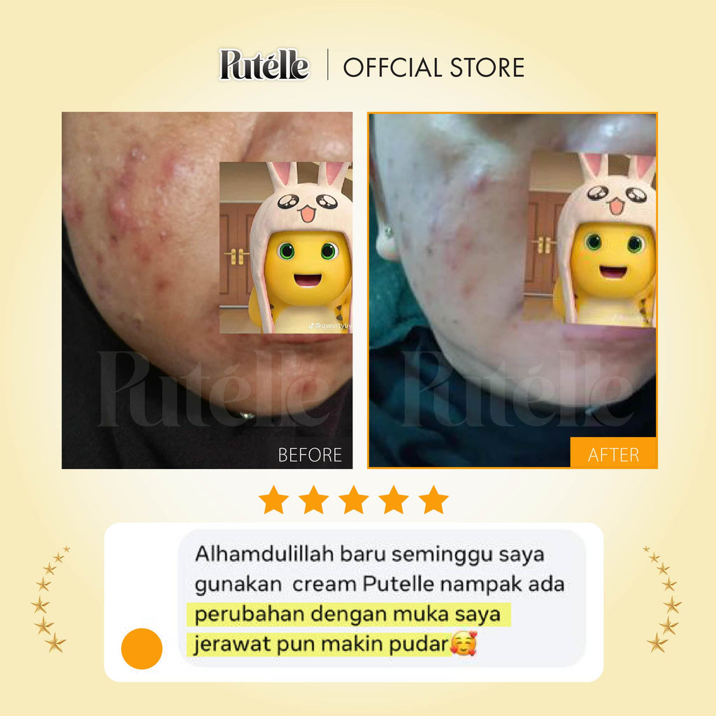 PUTELLE Radiance Cream 40g*1PC